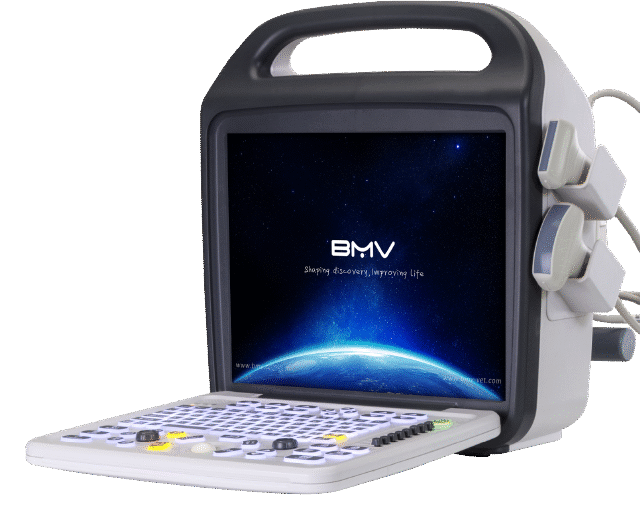BCU30 64 Channels Portable Color Doppler Ultrasound System
